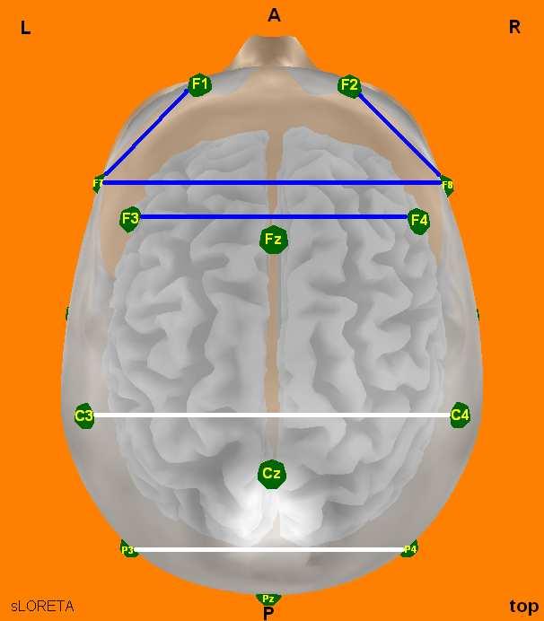 nebývají ve většině studií hodnoceny zvlášť, není vyloučeno, že mohou mít odlišné neurobiologické charakteristiky včetně EEG (Gordeev, 2008).