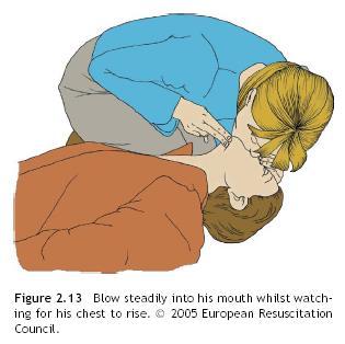 Kardiopulmonální resuscitace těhotných Obecné principy Volat o pomoc Průchodné