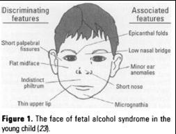 Etanol Fetální alkoholový sy