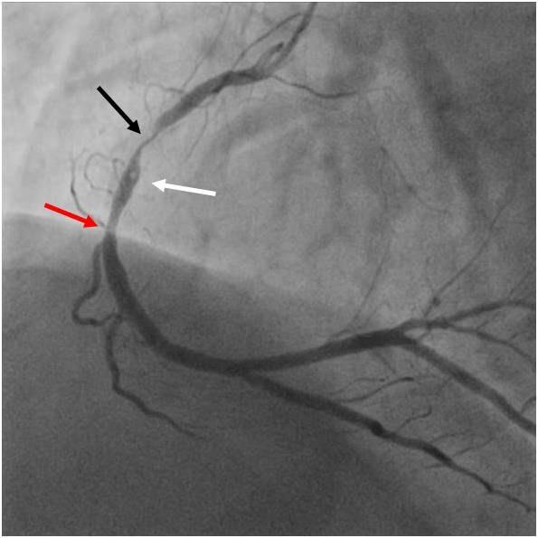 Angiografie