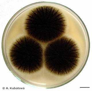 Aspergillus makroskopické znaky rychle rostoucí, plně vybarvené kolonie do pěti dnů kolonie bohatě pigmentované (v odstínech žluté, žlutozelené, zelené, zelenomodré, hnědé a černošedé) pigmentace je