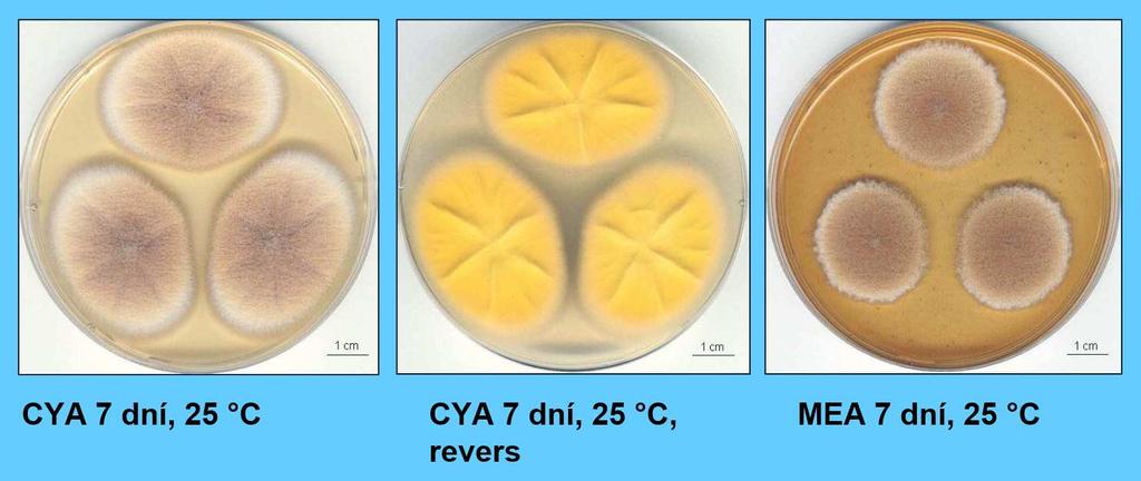 Aspergillus terreus kolonie rychle rostoucí, okrové, sametové, roste i při 37 C výskyt na potravinách a v prostředí budov, bývá izolován i z půdy původce IA se sklonem k