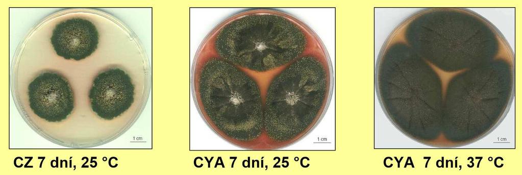 Aspergillus nidulans kolonie rychle rostoucí při 25 i 37 C, sametové, zelené tvorba plodnic syn. teleomorfa Emericella nidulans kontaminant potravin produkuje mykotoxin sterigmatocystin aj.