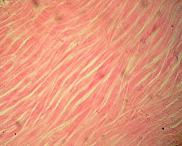 Tkáň svalová Svalovou tkáň tvoří buňky s velkým množstvím tzv. stažitelných bílkovin. Základní vlastností svalové tkáně je dráždivost a stažitelnost.