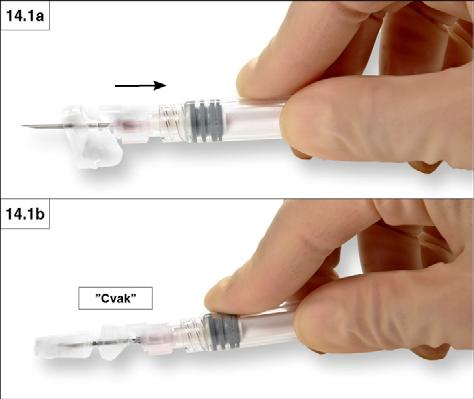 Krok 14: Po aplikaci injekce uzamkněte bezpečnostní krytku jehly. Můžete použít kteroukoliv z aktivačních metod uvedených níže. 1. Uzavření na rovném povrchu Zatlačte bezpečnostní krytku orientovanou tak, aby strana s páčkou směřovala dolů, proti rovnému povrchu (obrázky 14.