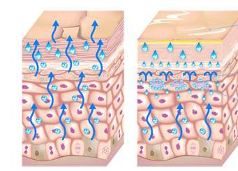 Voda v dermis je pravidelně a plynule rozptylována směrem k povrchu, zatímco se nasakuje do ostatních epidermálních vrstev.