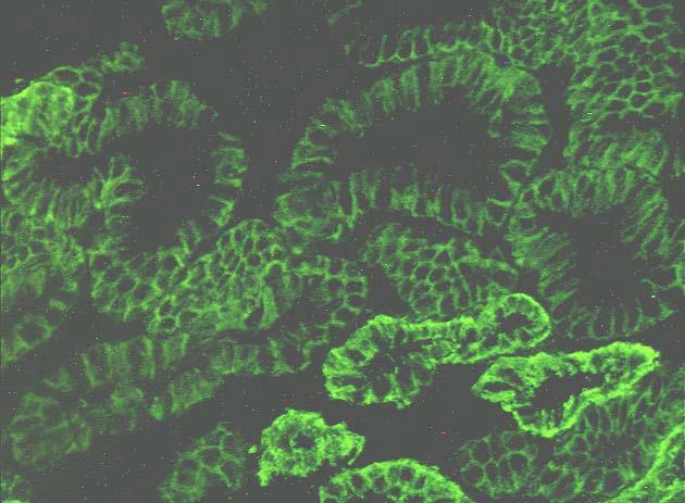 Imunohistochemie Fluochromy FITC Na+/K+ ATPáza v