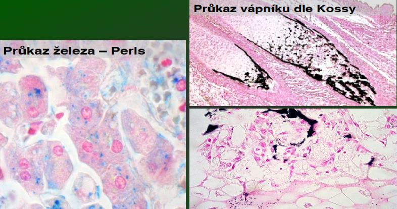 Histochemie Histochemie anorganických látek Průkaz vápníku dle Kossy dusičnan stříbrný