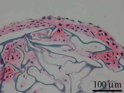 Pokles tření s postupem regenerace objasňuje autor tvořící se hydrofilní vrstvou na povrchu chrupavky.