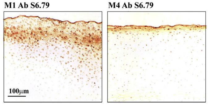 vzorky ze zatěžované části kondyly kolenního kloubu, vykazují podstatně nižší adhezní síly než vzorky z části M4. Tento jev je graficky znázorněn na obr. 5-61 B.