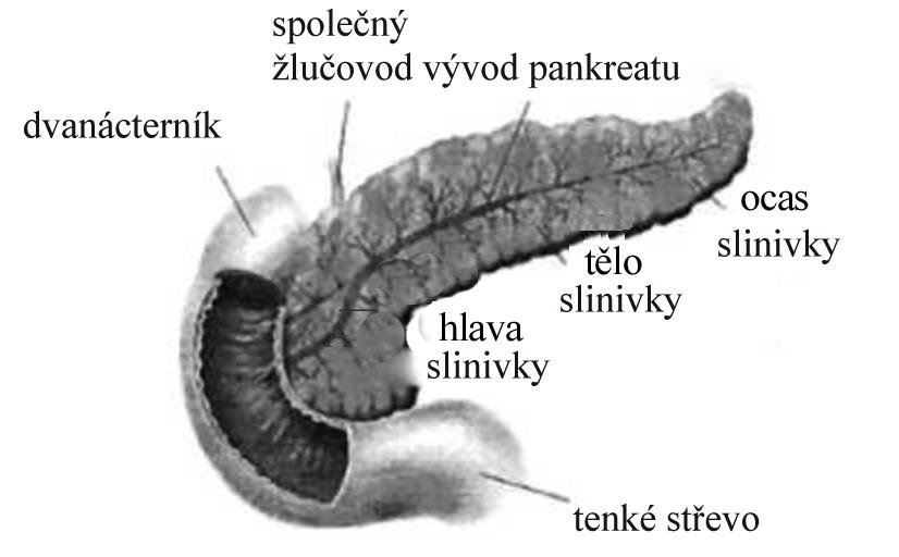 Obrázek znázorňuje slinivku břišní, společný žlučovod a tenké střevo. Co jsou to nádory Nádory jsou skupinou více vzájemně souvisejí cích onemocnění.