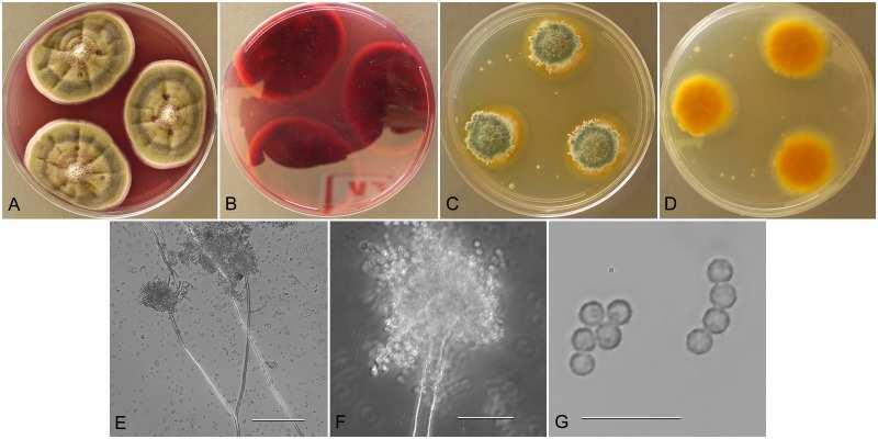 Mykotoxiny - přehled Sterigmatocystin producenti: Aspergillus versicolor, Aspergillus nidulans aj.