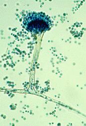 Globose conidia with roughened walls, bar=10 µm. http://www.mycology.adelaide.edu.