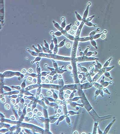 Další mikromycety kontaminující potraviny Food borne fungi Mikroskopické