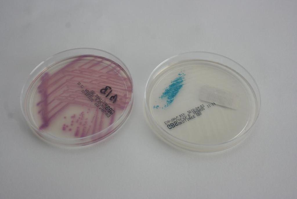 Obrázek 4 - Streptococcus agalactiae - krevní agar Obrázek 5 - Streptococcus agalactiae - chromogenní agar, vlevo pozitivní, vpravo negativní Treponema pallidum Treponema