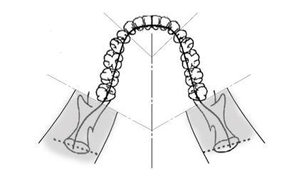 Upravená panoramatická projekce U upravené panoramatické projekce je základní geometrie snímkování stejná jako u standardní panoramatické projekce až na to, že zahrnuje pouze chrup.