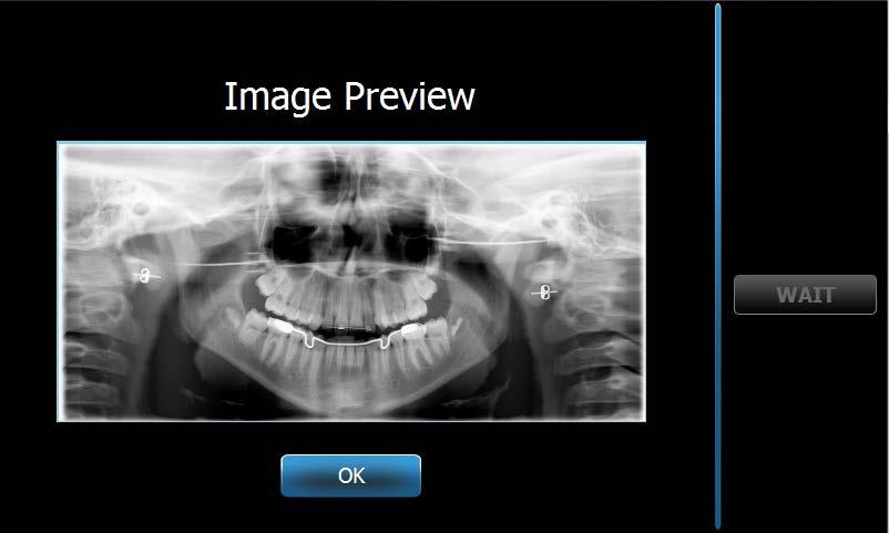 Recall Last Image (Zobrazit poslední snímek) Po pořízení rentgenového snímku nebo když klepnete na tlačítko Recall Last Image (Zobrazit poslední snímek) na obrazovce Options (Možnosti), zobrazí se