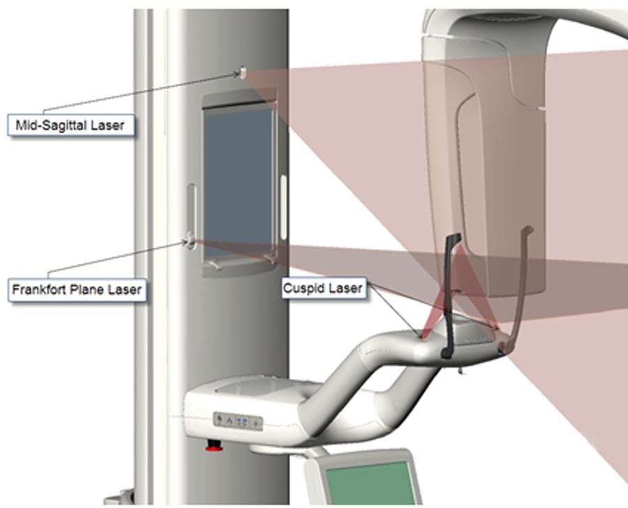 Používání polohovacích laserů Panoramatický rentgenový systém Progeny Vantage je vybaven třemi lasery,