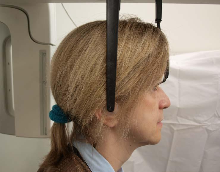 Laterální projekce Laterální projekce se provádí s cephalostatem v takové poloze, aby opěrky uší byly vyrovnané s rentgenkou.