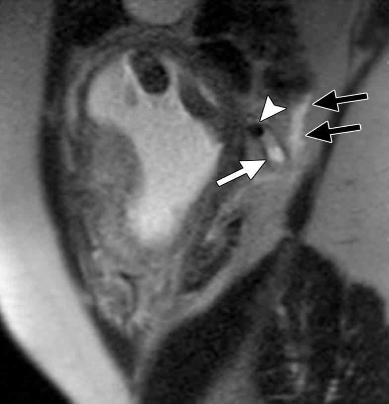 322115057 RSNA, 2012 One PowerPoint slide of each figure may be downloaded and used for educational, non-promotional purposes by an author for slide presentations only.