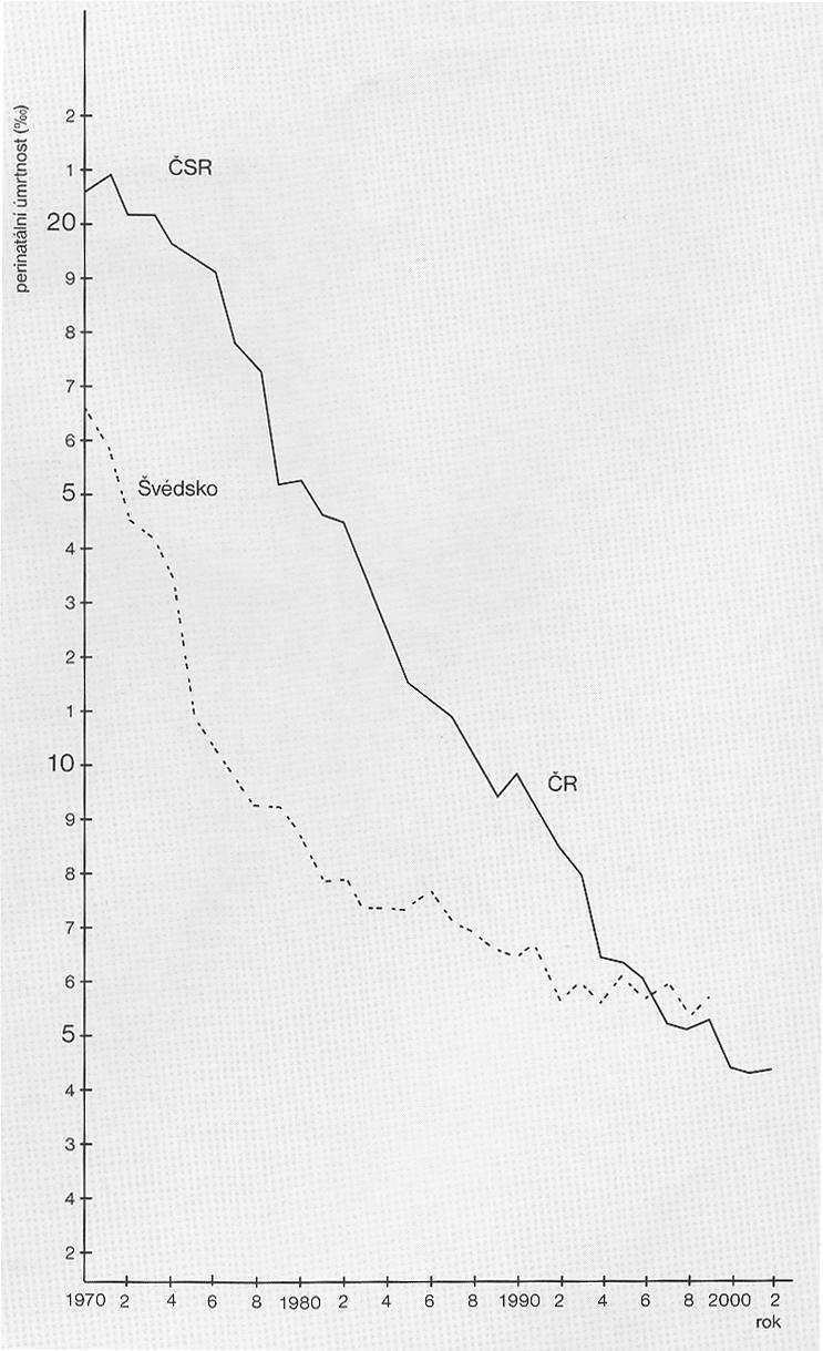 Příloha 10: Srovnání vývoje perinatální úmrtnosti v ČSR a ČR a ve