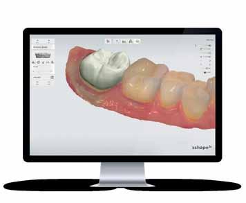 TRIOS Patient Monitoring