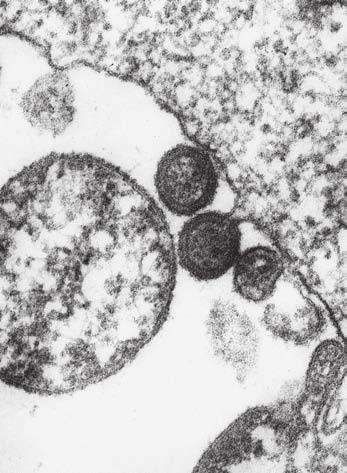 rysy. DNA polydnaviru rodu Bracovirus je integrována do genomu parazitoidů, kde je pak přítomna ve dvou oddělených klas - trech.