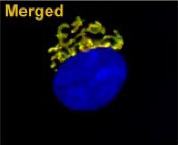 Golgiho aparát Pohyb a distribuce Diktyozóm Golgi apparatus, nucleus Krysí buňka Molecular