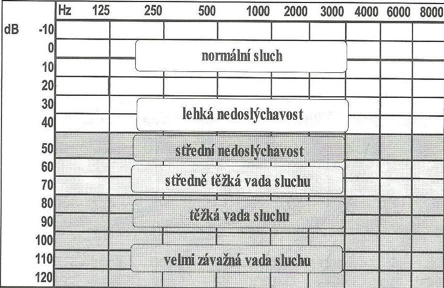 Tónová audiometrie Toto vyšetření se provádí na přístroji, který generuje tóny určitého kmitočtu (Hz) a intenzity (db). Jeho cílem je vyhledání sluchového prahu nemocného.