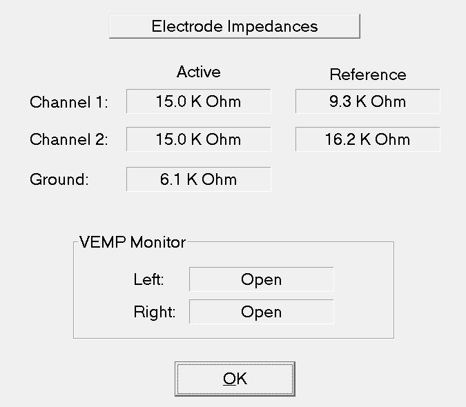 Obr. 24: Test impedance (vysoká impedance) Po vyhodnocení testu (Obr. 24) je vidět, že požadovaná impedance 5 kω je překročena.