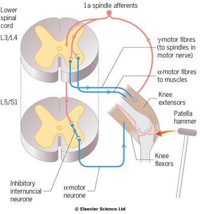 Změny v povrchových reflexech Normální flexorová plantární odpověď se stává extenzorovou (pozitivní Babinski). Abdominální reflexy a kremasterický reflex zanikají na postižené straně.