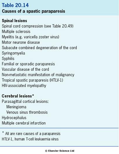 Hemiparéza 3. Most. Pontinní leze (např.plak sclerosis multiplex) postihují zřídka jen kortikospinální trakt. Často postiženy i jádra hlavových nervů s ochrnutím VI. a VII.