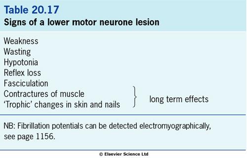 Příčiny lézí LMN Příznaky poruchy dolního motoneuronu Postižení jader hlavových nervů a alfa motoneuronů předních rohů míšních (poliomyelitis) Míšní oblouk-protruze disku Postižení periferního nervu