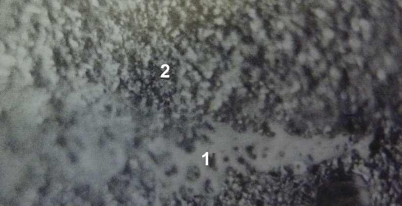 FSI VUT DIPLOMOVÁ PRÁCE List 24 korundovým práškem. Další technologie využívá keramickou hmotu hydroxyapatit, který pokrývá porézní vrstvu implantátu [3].
