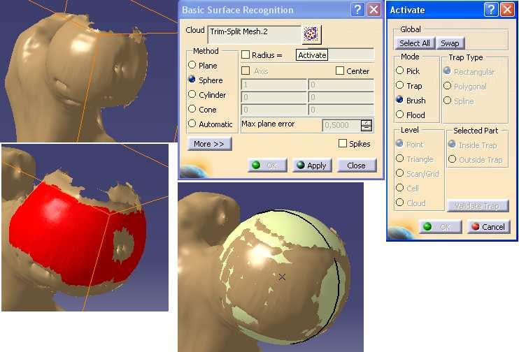 V další kroku příkazem Basic Surface Recognition vepíšeme válec do hlavice kyčelního