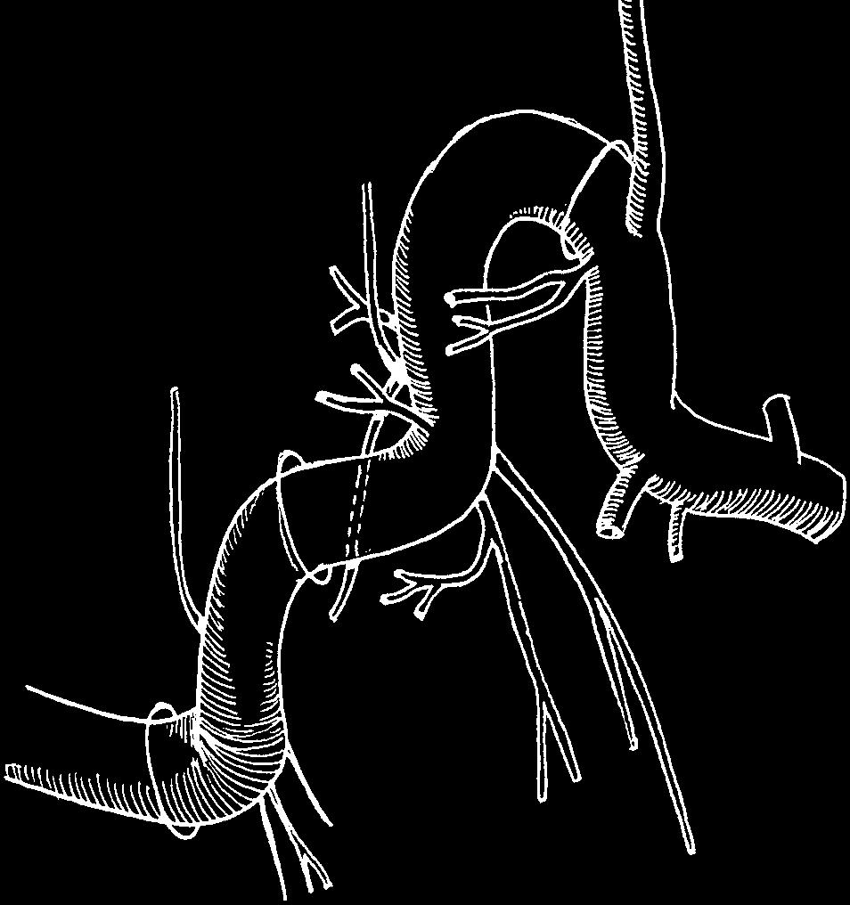 pterygoideus pars cervicalis locus Kieselbachi 9 B. labialis sup. A a. nasopalatina 11