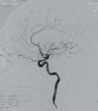 B, ramus = r.) Obr. A: 1 aa. nasales posteriores superiores, 2 a. ethmoidalis anterior, 3 a. ethmoidalis posterior, 4 a.