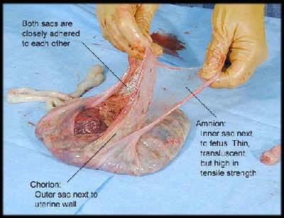 - hemochorialis 15-25