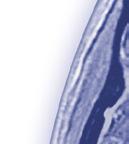 vysokodávkovaným IFN β-1a 1 SNÍŽENÍ RIZIKA RELAPSU téměř o
