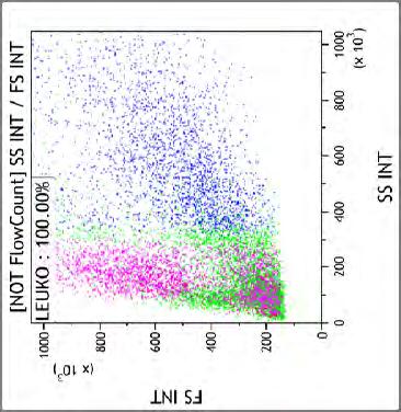 B NHL (DLBCL), (JM, 1967 m) 59 %