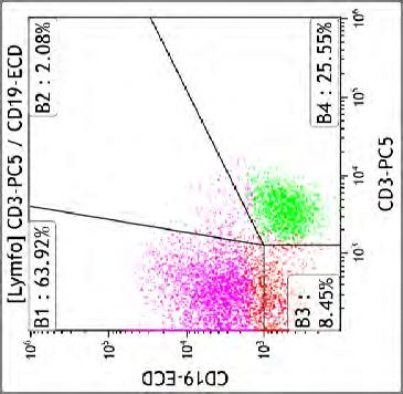 CD19+ B lymfocytů