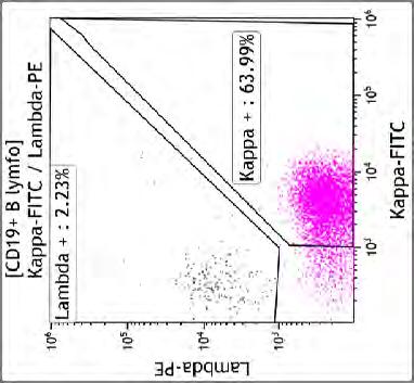 (kappa+cd10+cd20+cd22+cd79b+cd38+cd5 CD23 FMC ), T