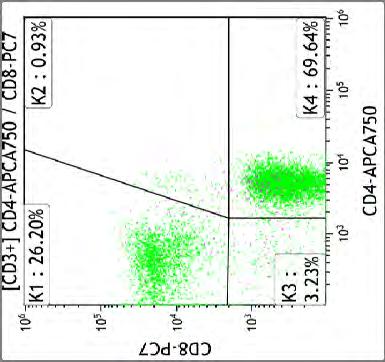 CD3+CD2+CD5+CD7+ s IRI = 2,6