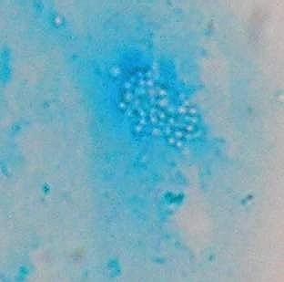 Spíše pro výzkumné a výukové účely: Mikroskopie orálního biofilmu V preparátech barvených Gramem lze pozorovat shluky bakterií (G+ i G- ) a případně buňky makroorganismu (epitelie apod.