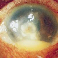 Enterobakterie a oko Enterobakterie nemají specifický vztah k oku.