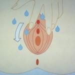 Cévkování ženy - postup sterilní pomůcky na pojízdný sterilní vozík (na dosah) edukace pacientky, omytí genitálu nasazení sterilních rukavic zarouškování
