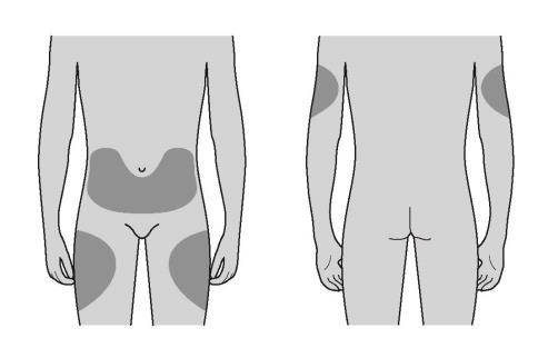 Kam injekci aplikovat? Nejlepšími místy pro aplikaci přípravku je horní část stehen a břicho. Osoba, která o Vás pečuje, může použít také vnější část Vaší paže. Jak injekci podat? 1.