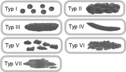 Obrázek 2Bristolská škála typů stolice zdroj 6 http://www.mudr.