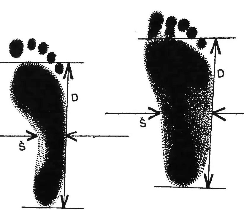 7): k vyhodnocení je běžně používán index, který je poměrem mezi délkou otisku planty nohy bez prstů k šířce nohy u hlavičky V.