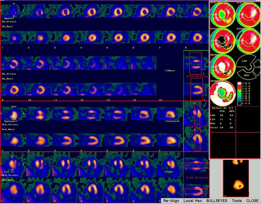 dosažená TF, TK, EKG změny, potíže Použité přístroje Popis obrazů Závěr interpretace